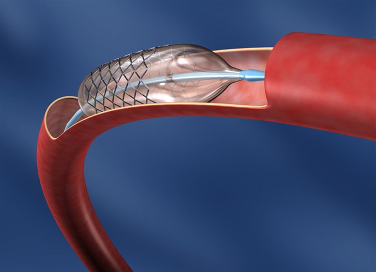 Увлажнение воздуха в производстве медицинского оборудования